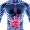 Síndrome de intestino permeable.
