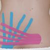 ¿Esparadrapo de colores? No, Kinesio-Taping