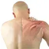 Cómo la fascia y las tensiones viscerales pueden estar afectando tu tendinopatía de hombro