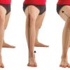 Valgo de Rodilla, Qué es y cual es su tratamiento o corrección 