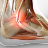 5 Curiosidades que no sabías sobre los ligamentos, su estructura y su funcionamiento