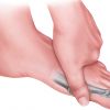 Metatarsalgia, síntomas, causas, complicaciones y tratamiento