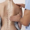 ¿Tienes una escoliosis funcional? Cómo la disfunción visceral puede modificar tu postura