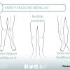 Rodillas varas o valgas. Dos alteraciones posturales y dos ejercicios para trabajarlas