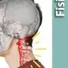 Los 3 MEJORES EJERCICIOS para la RECTIFICACIÓN CERVICAL