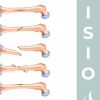 Tipos de FRACTURAS de hueso y su tratamiento y recuperación