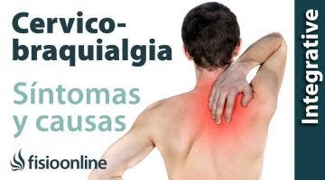 ¿Qué es la cérvico-braquialgia o dolor cervical irradiado y cuáles son sus causas y síntomas?