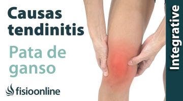 Causas de la tendinitis de la pata de ganso según la medicina natural