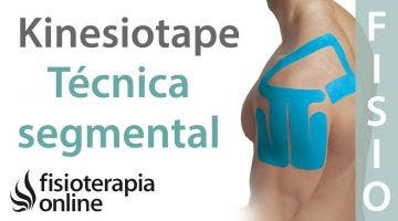 10 Técnica segmental del Kinesiotaping