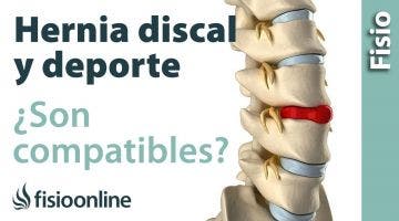 Son incompatibles hernias y ejercicio