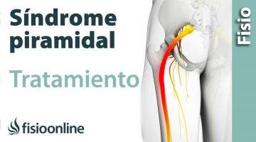 Síndrome del piramidal. Tratamiento con ejercicios, auto masajes y estiramientos.