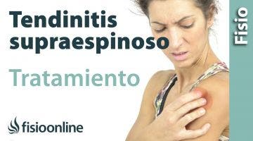 Tendinitis del supraespinoso. Tratamiento con ejercicios auto-masajes y estiramientos.
