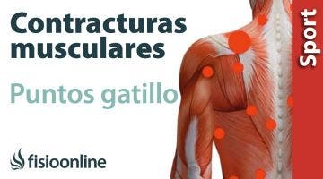 3 cosas que debes saber sobre la contracturas musculares y puntos gatillo