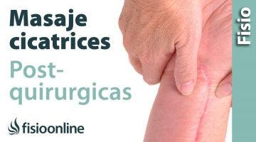 14.Auto-masaje para las cicatrices post-quirúrgicas.