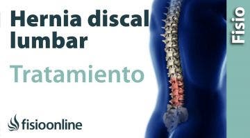 Hernia discal lumbar. Tratamiento con ejercicios, auto masajes y estiramientos