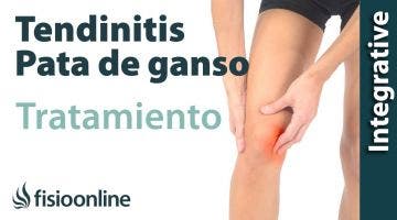 Tendinitis de pata de ganso. Tratamiento con ejercicios auto-masajes y estiramientos.