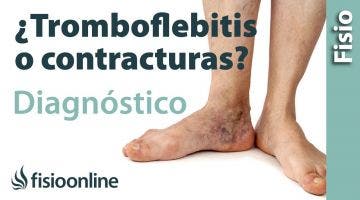 Cómo diferenciar una tromboflebitis de un dolor muscular  de la pantorrilla