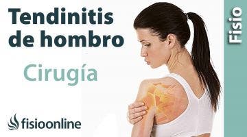 Cirugía y operación para la tendinitis de hombro y el síndrome subacromial.