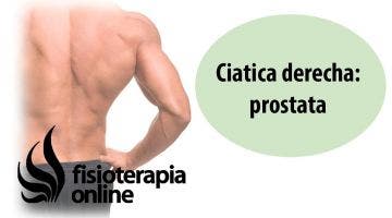 Cíatica o ciatalgia derecha y su relación con la disfunción de próstata