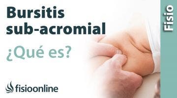 Bursitis sub acromial o del hombro