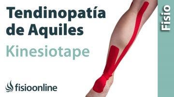 14 Kinesiostaping en la tendinopatia de Aquiles