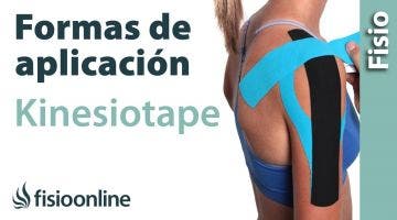 2 Formas de aplicación del Kinesiotaping