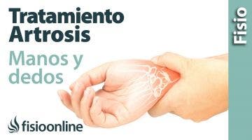 Artrosis de las manos y dedos