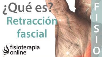 Retracción muscular o fascial - Qué es y cuales son sus causas