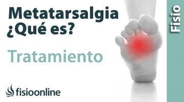 Metatalsargia. Tratamiento mediante ejercicios, auto masajes y estiramientos