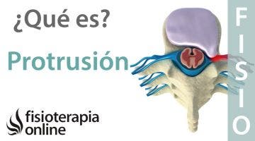 Protrusión o complejos disco osteofitarios posteriores. ¿Qué es?