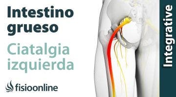 Ciática o ciatalgia izquierda y su relación con el intestino grueso y colón irritable