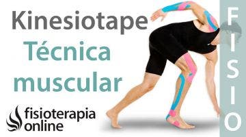 5 Técnica muscular del Kinesiotaping