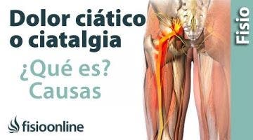¿Qué es la ciática o ciatalgia y cuáles son sus causas?