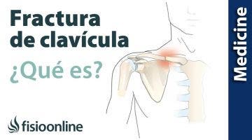 Tratamiento para la fractura de clavícula