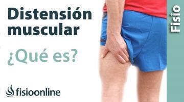 Distensión muscular o ligamentosa - Qué es, cómo sucede y cuáles son sus características