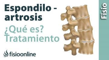 ¿Qué es la espondiloartrosis?