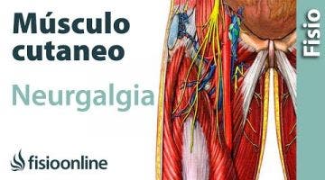 16# Neuralgia del nervio músculocutaneo. Qué es, causas, síntomas y tratamiento.