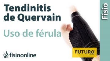 Tendinitis o tenosinivitis de De Quervain - Cómo, cuándo y por qué utilizar férula