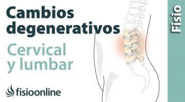 Cambios degenerativos lumbares o cervicales. ¿Qué es?