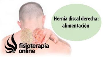 Hernia discal cervical derecha. Alimentación, nutrición y modificaciones en la dieta.