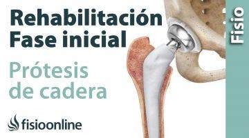 Rehabilitación de Prótesis de Cadera - Primera Fase