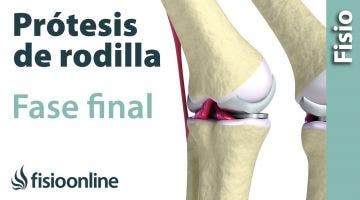 Rehabilitación de Prótesis de Rodilla - Tercera Fase