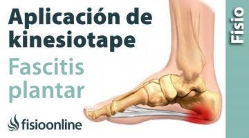 13 Kinesiotape para la fascitis plantar