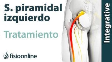 Tratamiento del Sindrome Piramidal izquierdo