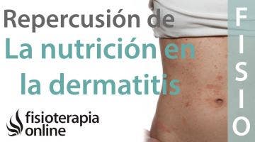 Importancia de la nutrición en el desarrollo en la dermatitis atópica