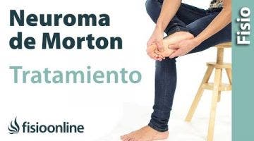 Neuroma de Morton. Tatamiento con ejercicios, auto-masajes y estiramientos