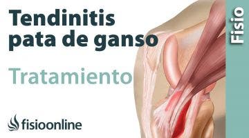 Tendinitis de la Pata de Ganso. Ejercicios, consejos y recomendaciones de un fisioterapeuta.