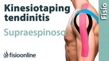 16 Kinesiotaping para la tendinopatia del supraespinoso