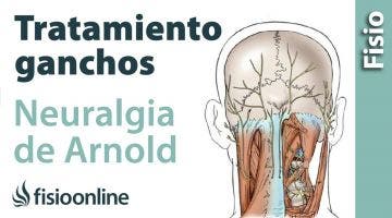 Tratamiento de fisioterapia con fibrolisis o ganchos para la neuralgia de Arnold