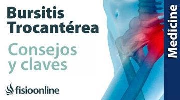 Trocanteritis o bursitis trocantérea: claves para entenderla
